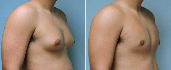 Patient Gallery