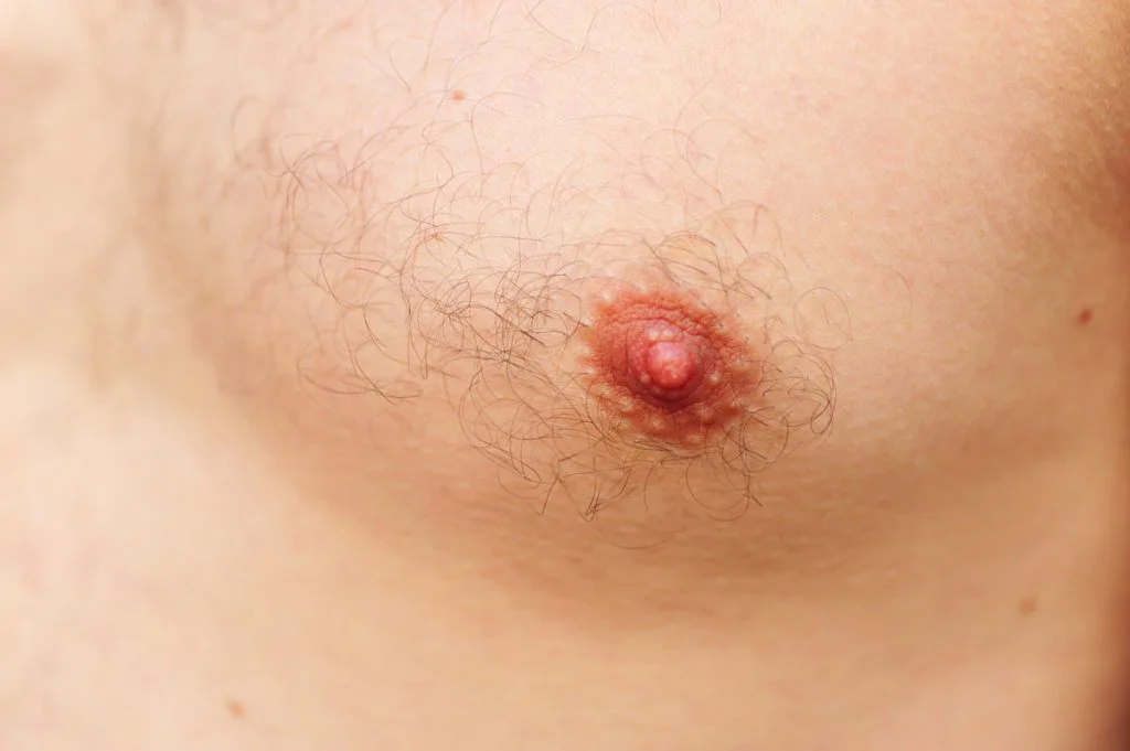 man breast and nipple area
